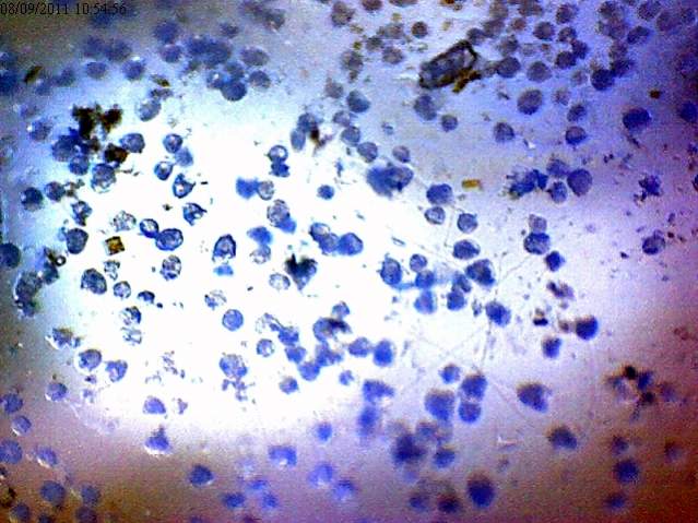 These are higher magnification of what could be Euglena.  Really wish I had bought the 400x microscope now!!